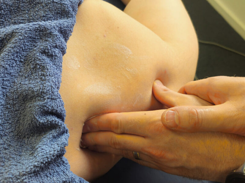 A physiotherapist performing a shoulder massage as part of treatment.